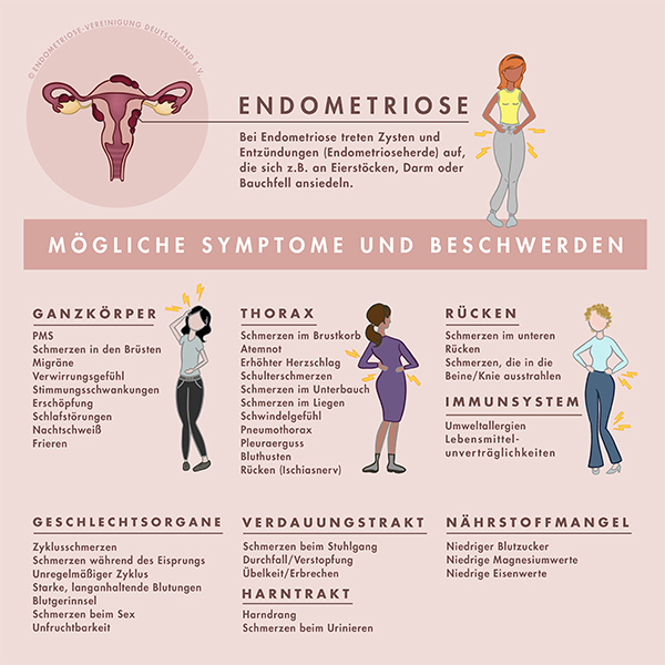Symptome Endometriose_Endovereinigung